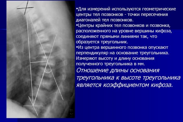 Спрут мега кракен
